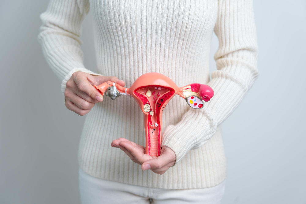 Polycystic Ovary Syndrome